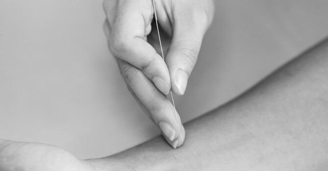 Dry Needling
